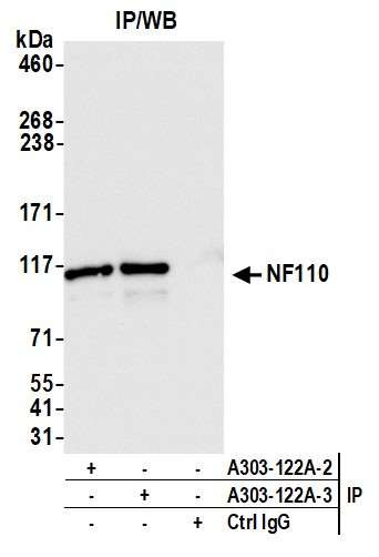 NF110 Antibody in Immunoprecipitation (IP)