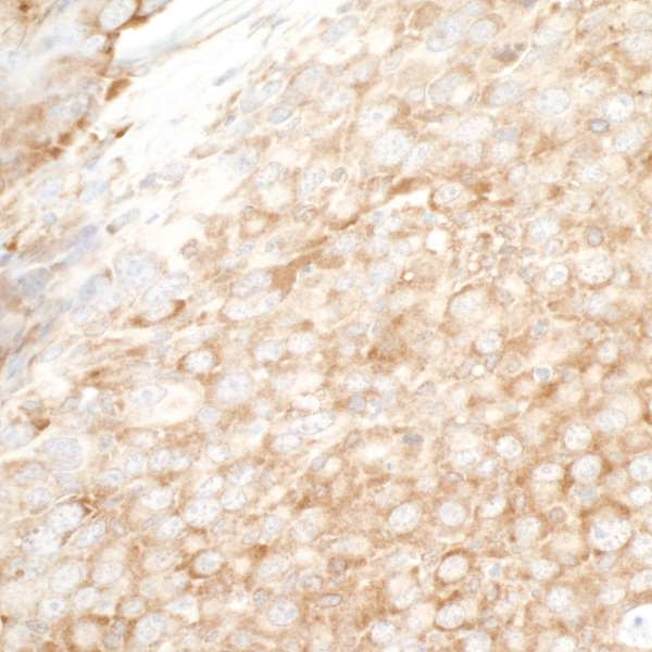 YB1 Antibody in Immunohistochemistry (Paraffin) (IHC (P))