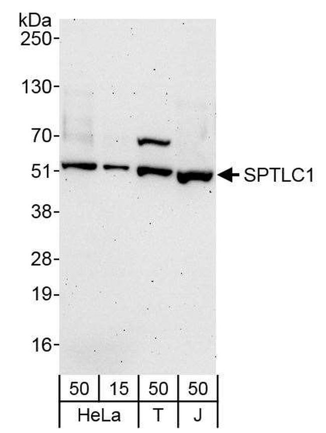 SPTLC1 Antibody in Western Blot (WB)