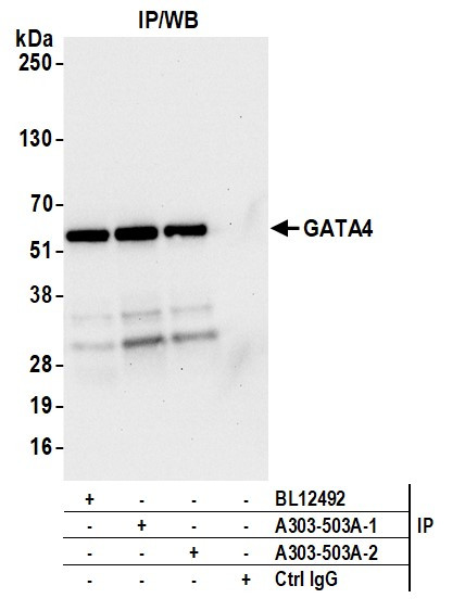 GATA4 Antibody in Immunoprecipitation (IP)