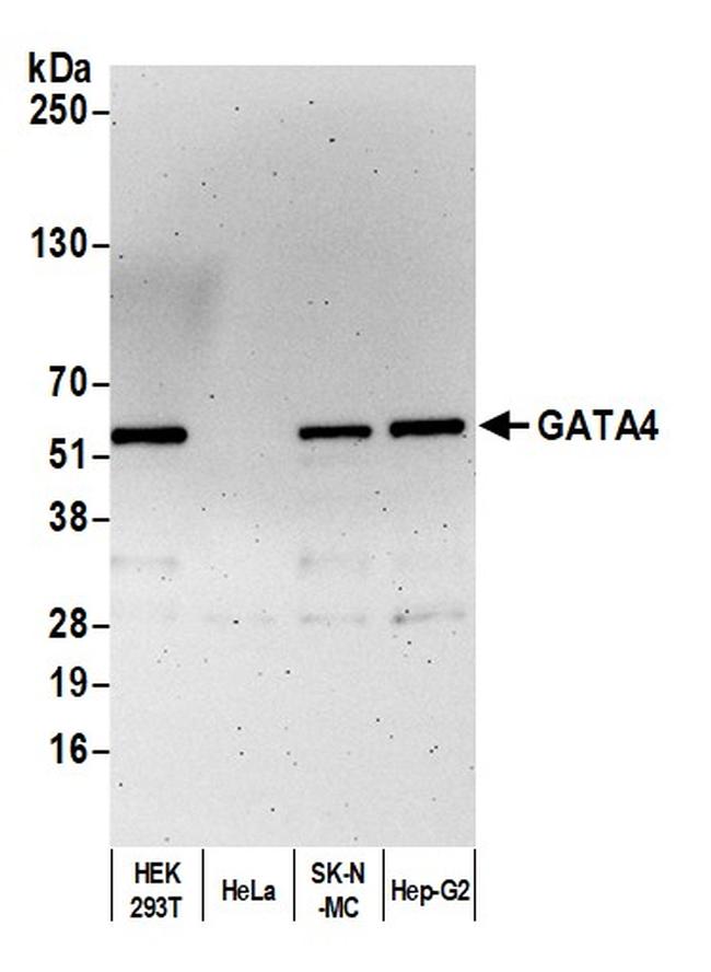 GATA4 Antibody in Western Blot (WB)