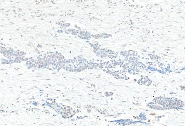 TAF1 Antibody in Immunohistochemistry (Paraffin) (IHC (P))