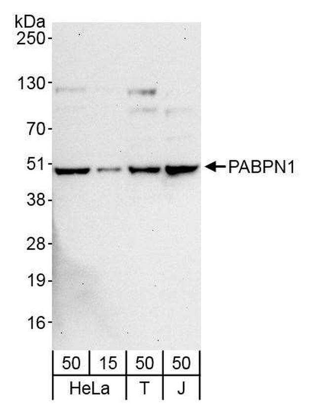 PABPN1 Antibody in Western Blot (WB)