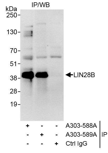 LIN28B Antibody in Immunoprecipitation (IP)