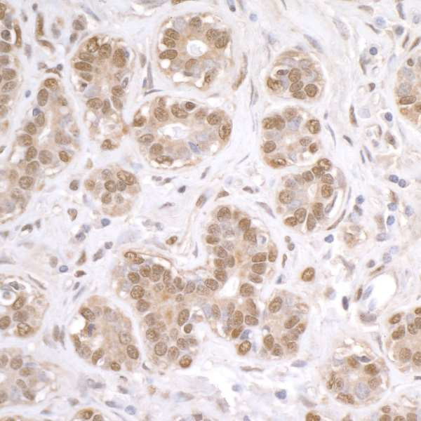 FUS Antibody in Immunohistochemistry (Paraffin) (IHC (P))