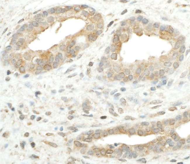 RPS5 Antibody in Immunohistochemistry (Paraffin) (IHC (P))