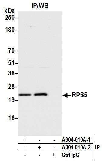 RPS5 Antibody in Immunoprecipitation (IP)