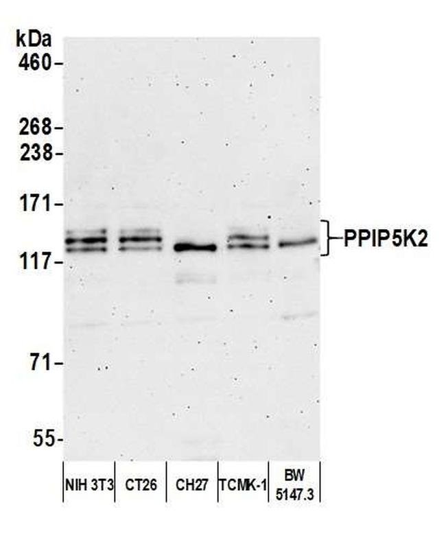 PPIP5K2 Antibody in Western Blot (WB)