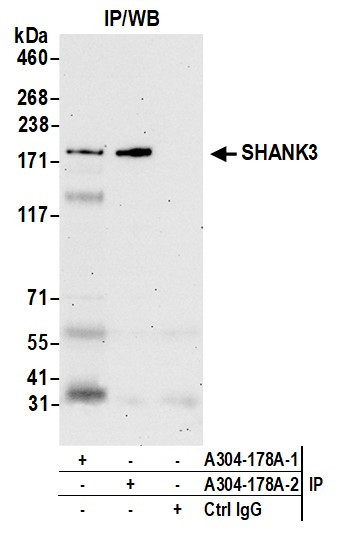 SHANK3 Antibody in Immunoprecipitation (IP)