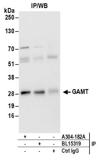 GAMT Antibody in Immunoprecipitation (IP)