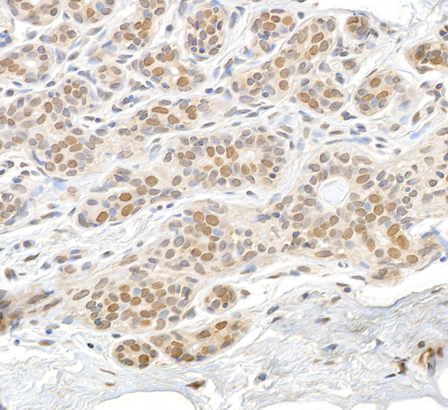 RAN Antibody in Immunohistochemistry (Paraffin) (IHC (P))