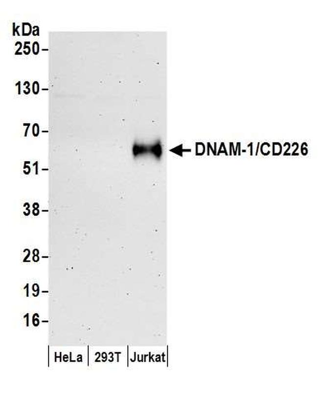 DNAM-1 Antibody in Western Blot (WB)