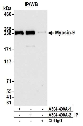 Myosin-9 Antibody in Immunoprecipitation (IP)