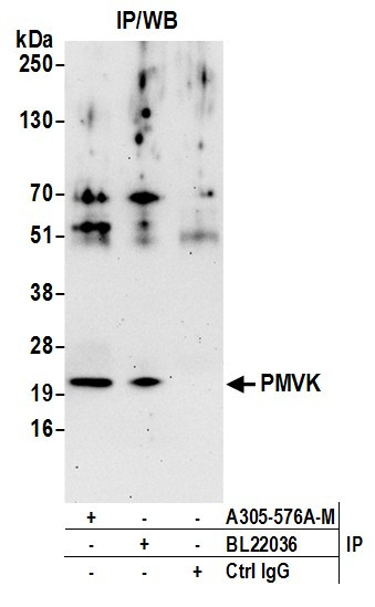 PMVK Antibody in Immunoprecipitation (IP)