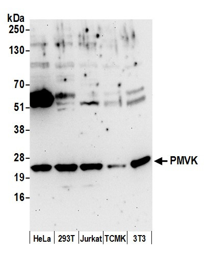 PMVK Antibody in Western Blot (WB)