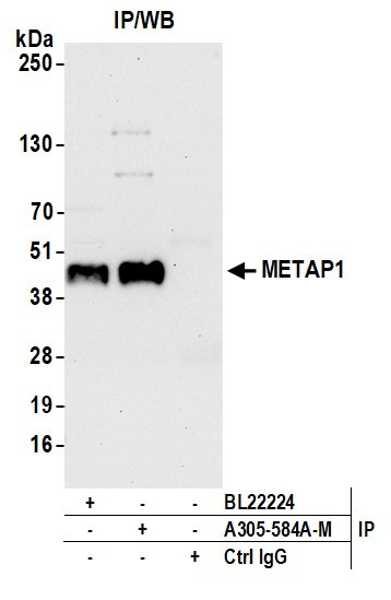 METAP1 Antibody in Immunoprecipitation (IP)