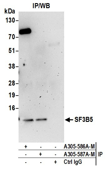 SF3B5 Antibody in Immunoprecipitation (IP)