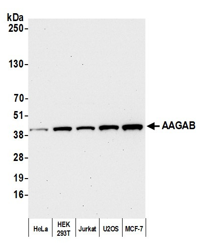 AAGAB Antibody in Western Blot (WB)