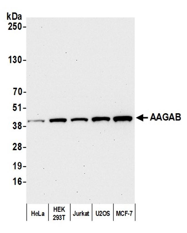 AAGAB Antibody in Western Blot (WB)