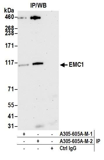 EMC1 Antibody in Immunoprecipitation (IP)