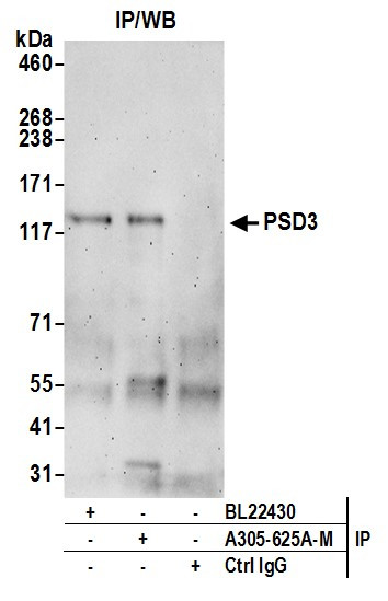 PSD3 Antibody in Immunoprecipitation (IP)