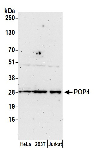 POP4 Antibody in Western Blot (WB)