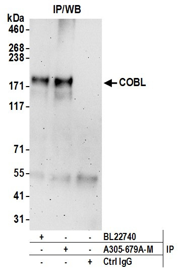 COBL Antibody in Immunoprecipitation (IP)