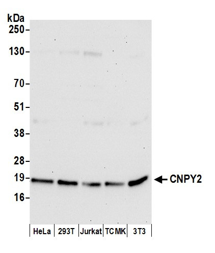 CNPY2 Antibody in Western Blot (WB)