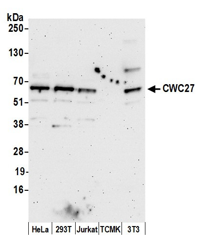 CWC27 Antibody in Western Blot (WB)