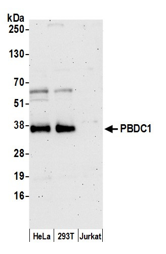 PBDC1 Antibody in Western Blot (WB)