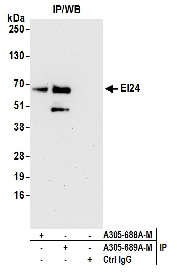 EI24 Antibody in Immunoprecipitation (IP)