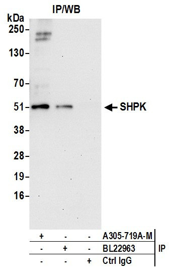 SHPK Antibody in Immunoprecipitation (IP)