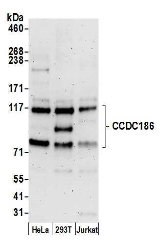 CCDC186 Antibody in Western Blot (WB)