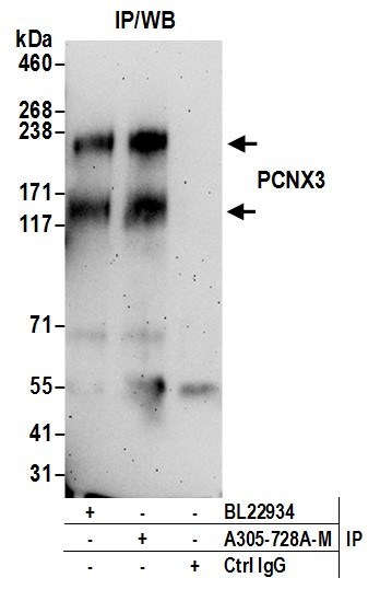 PCNX3 Antibody in Immunoprecipitation (IP)