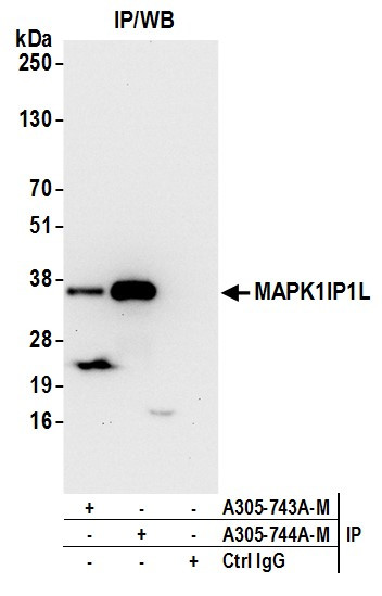 MAPK1IP1L Antibody in Immunoprecipitation (IP)