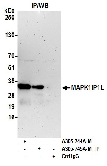 MAPK1IP1L Antibody in Immunoprecipitation (IP)