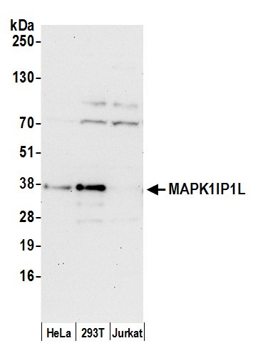 MAPK1IP1L Antibody in Western Blot (WB)