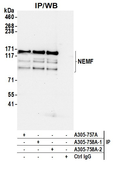 NEMF Antibody in Immunoprecipitation (IP)