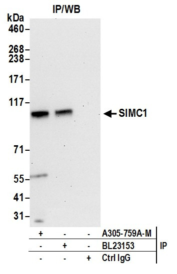 SIMC1 Antibody in Immunoprecipitation (IP)