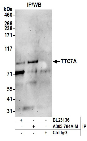TTC7A Antibody in Immunoprecipitation (IP)