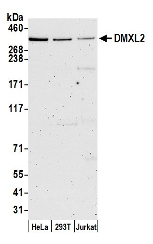 DMXL2 Antibody in Western Blot (WB)