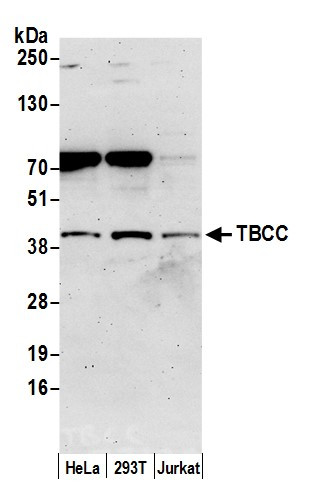 TBCC Antibody in Western Blot (WB)