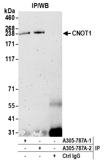 CNOT1 Antibody in Immunoprecipitation (IP)