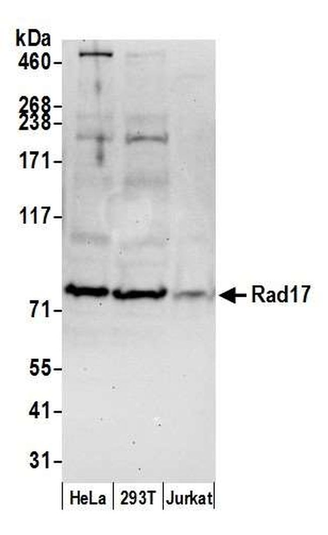 Rad17 Antibody in Western Blot (WB)