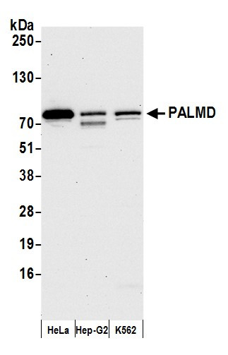 PALMD Antibody in Western Blot (WB)