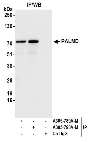 PALMD Antibody in Immunoprecipitation (IP)