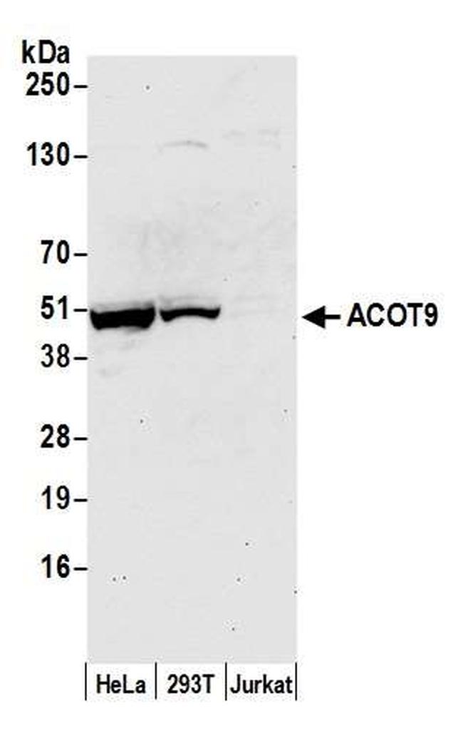 ACOT9 Antibody in Western Blot (WB)