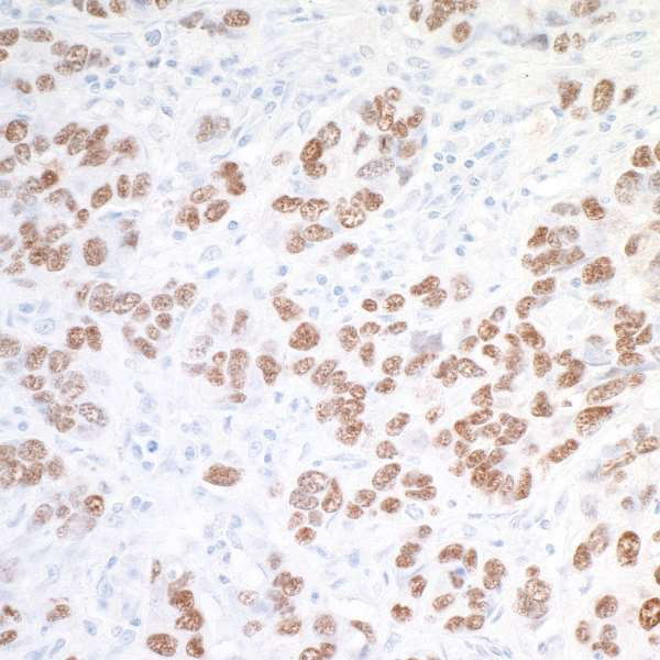 SOX10 Antibody in Immunohistochemistry (Paraffin) (IHC (P))