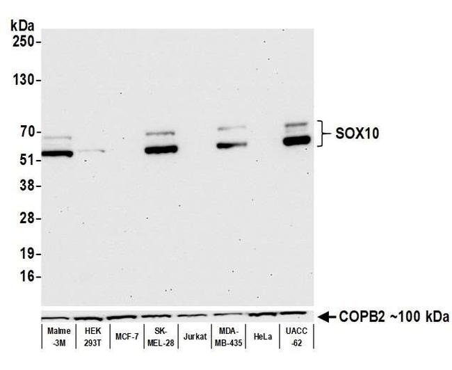 SOX10 Antibody in Western Blot (WB)