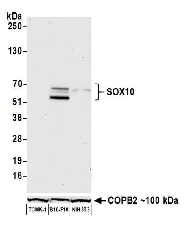 SOX10 Antibody in Western Blot (WB)